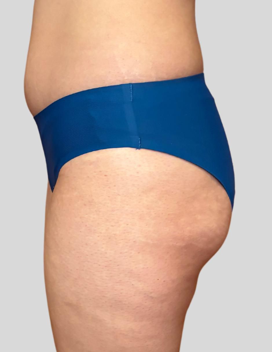 Bikini a la cadera para mujer 5